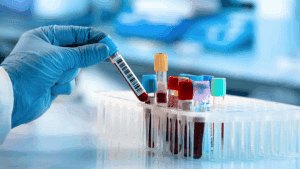 Gloved hand holding a blood sample vial for pharmacokinetic testing